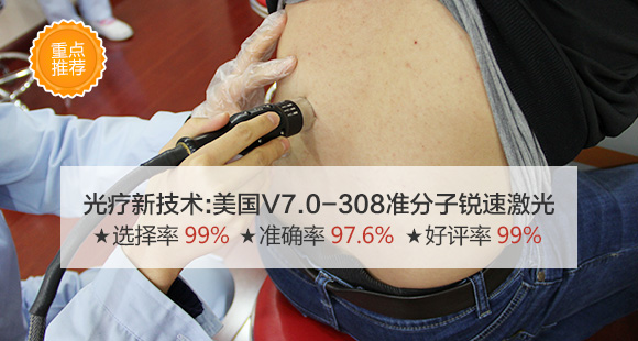 580北京308激光背部.jpg